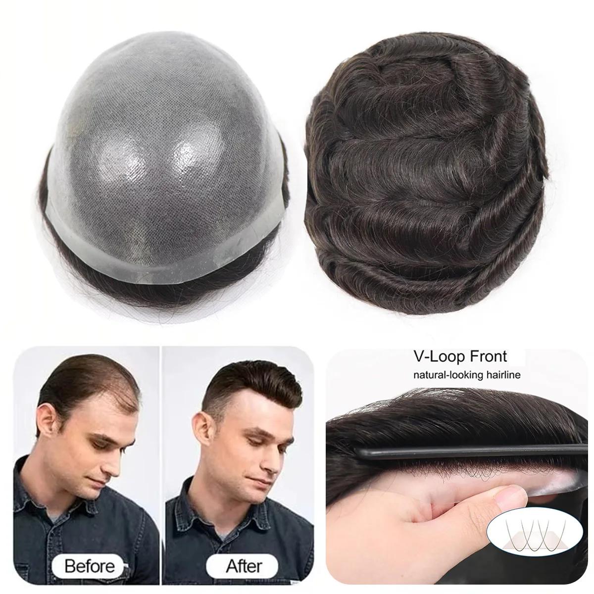 Toupet de peau fine, cheveux naturels, naissance des cheveux naturelle, prothèse capillaire à Double