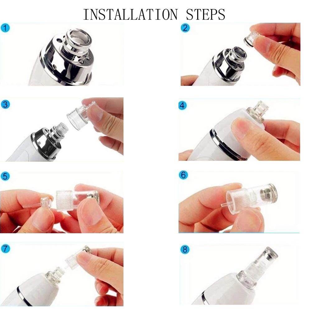 DermDelhi-Machine de peeling de la peau sous vide pour le visage, points noirs, élimination de l'acn