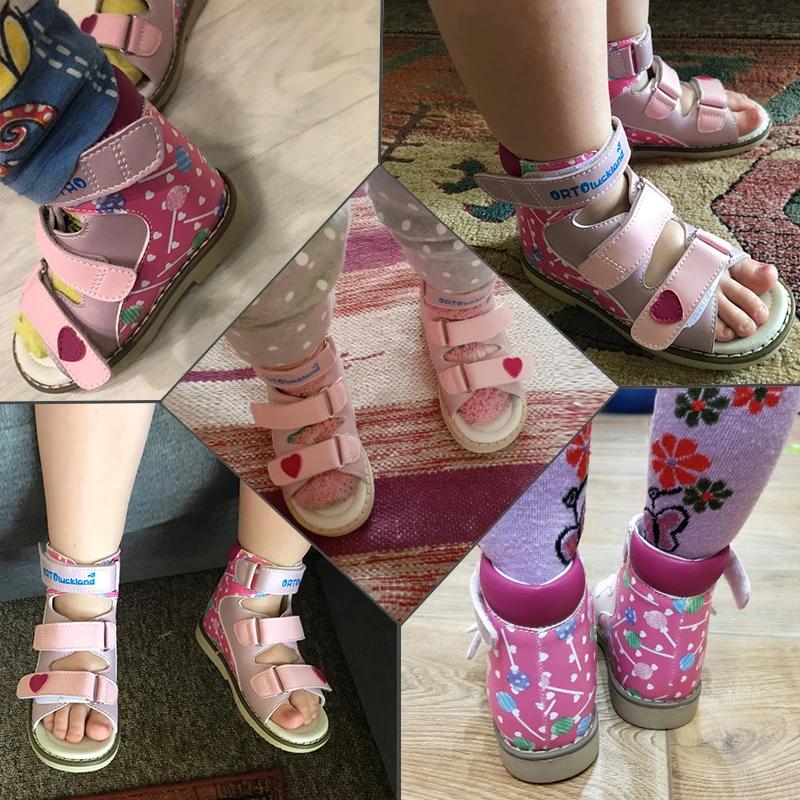 Informations sur Uckland-Sandales d'été pour filles, chaussures Orth4WD pour enfants, style coréen, 