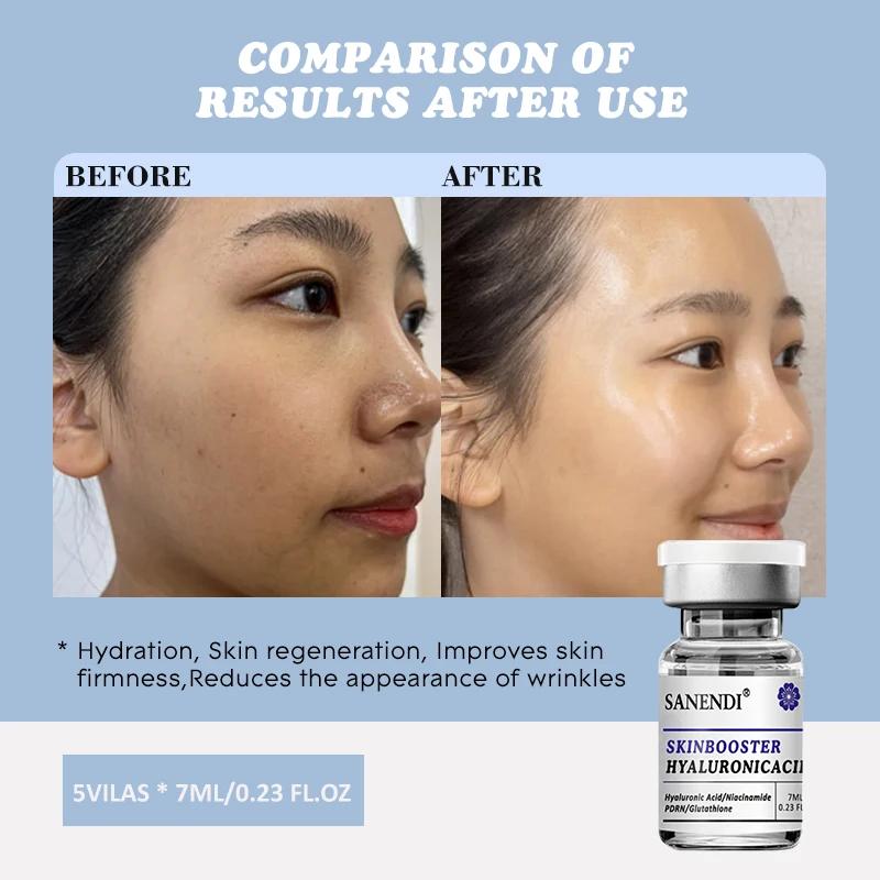 Acide hyaluronique PDRN Skinbootser avec Niacinamide Gel de soin de la peau hydratant et verrouillag