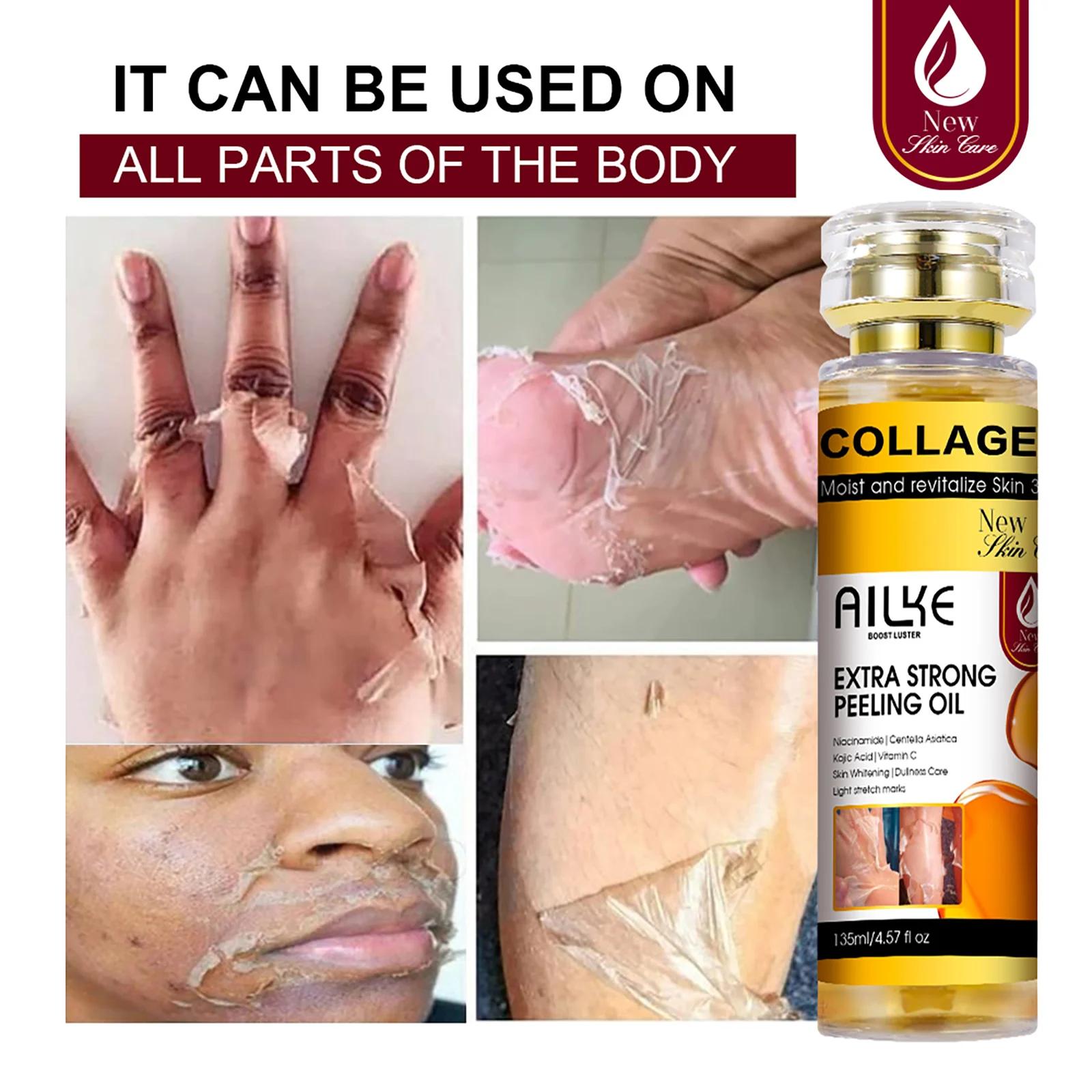 AILKE Huile peeling extra forte au collagène, peau blanchissante, solution exfoliante pour le visage