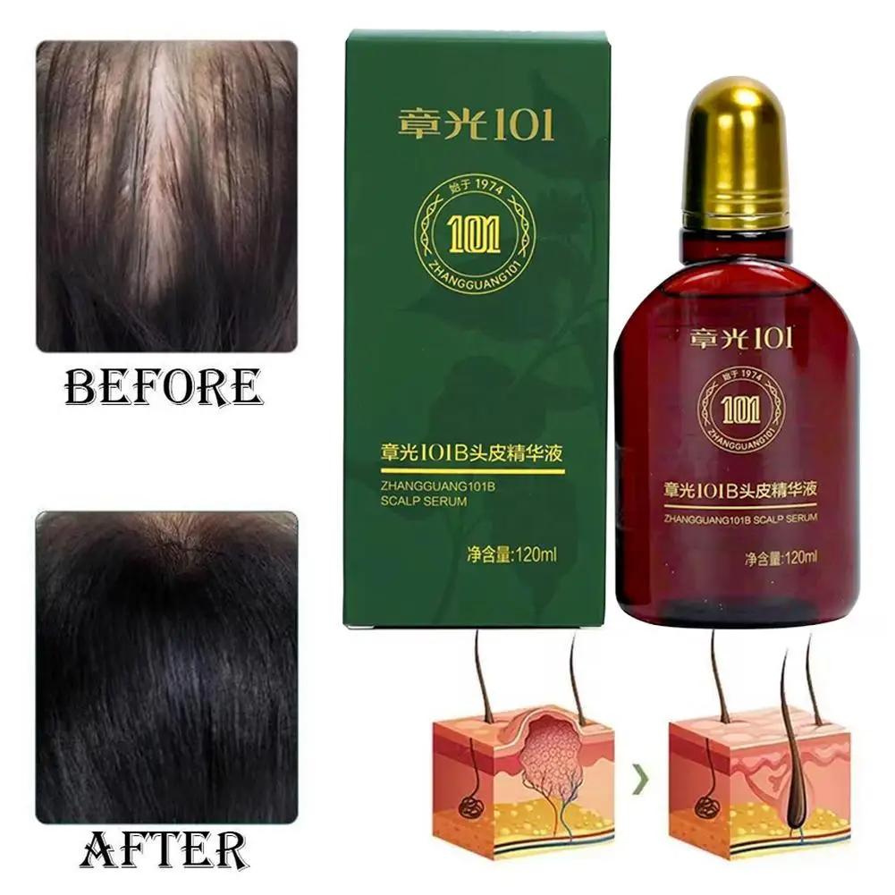 Lotion pour cheveux du cuir chevelu, 120ml, Essence de Ginseng et de gingembre, liquide, revitalisan