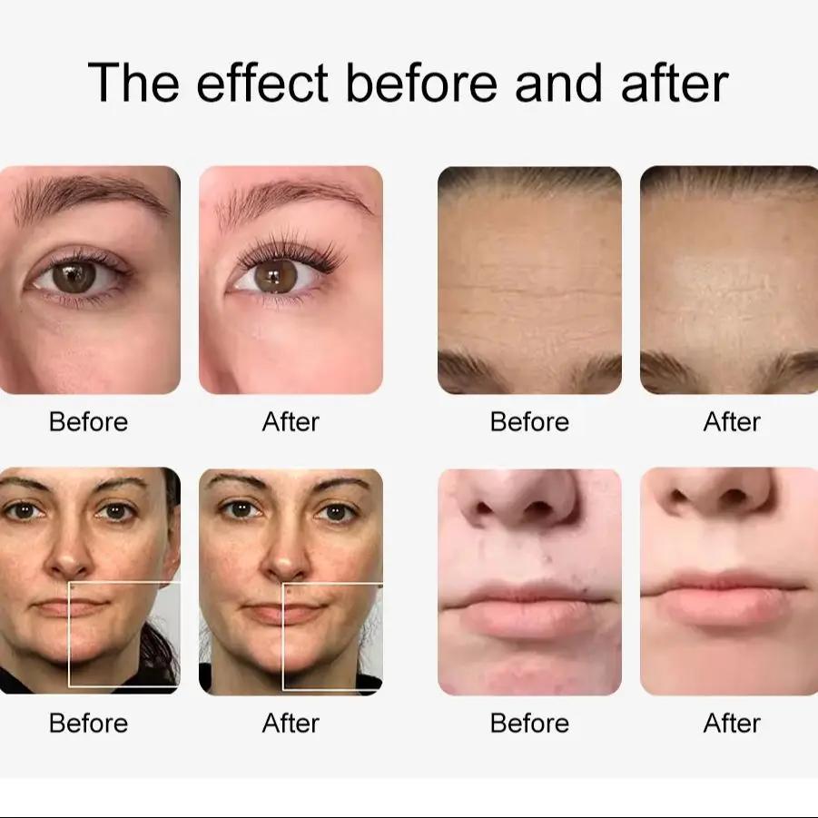 Hydro Machine à oxygène et eau 12 en 1, Lifting du visage, nettoyage en profondeur, Dermabrasion, Pe