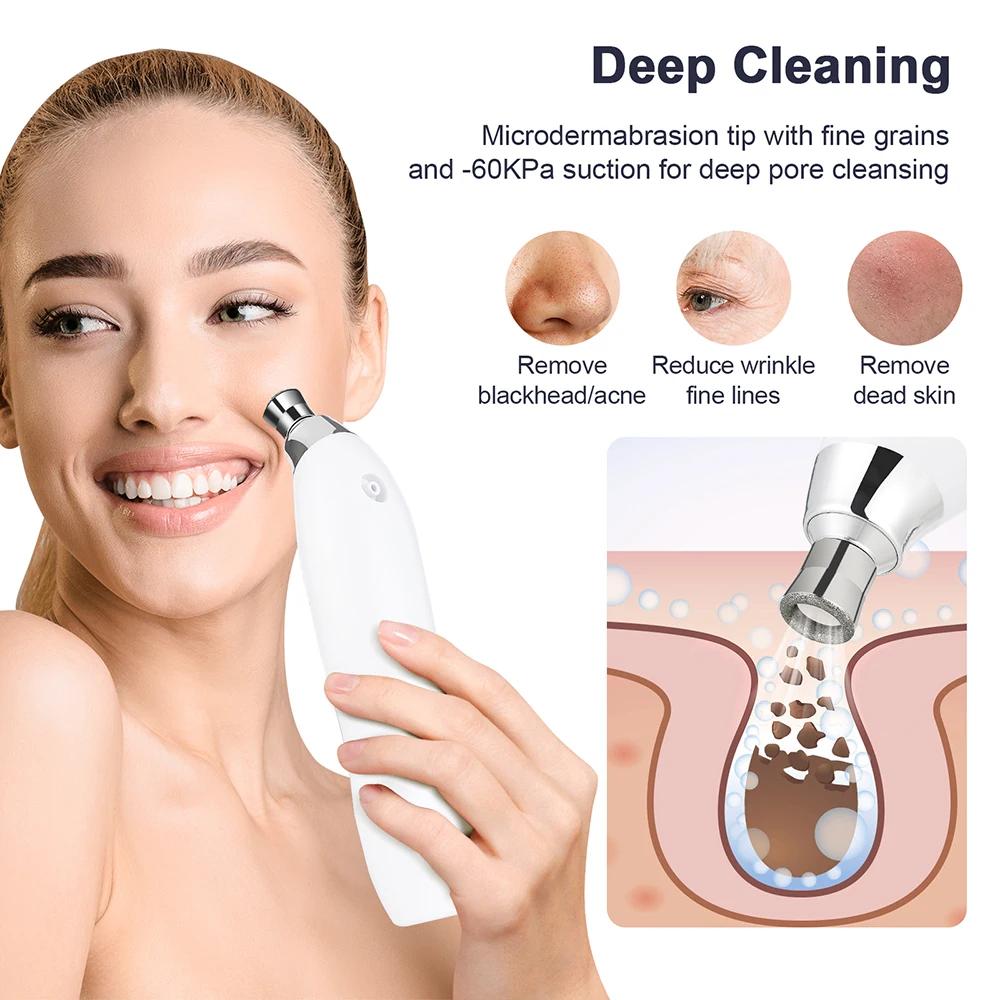 Machine portative d'épluchage du visage de Microdermabrasion de diamant hydratant aérographe Exfolia