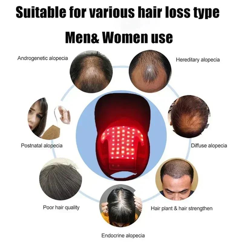 Bonnet de thérapie à la lumière rouge LED, casque de croissance des cheveux, chapeau laser à Diode, 