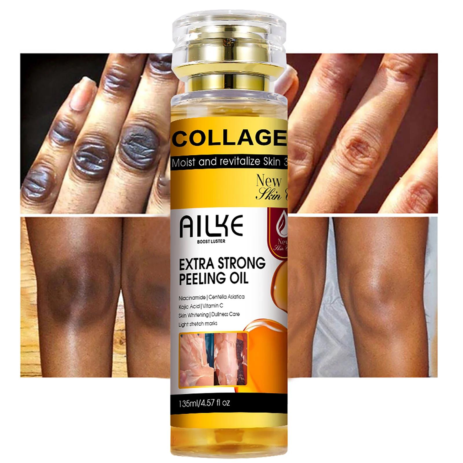 AILKE Huile peeling extra forte au collagène, peau blanchissante, solution exfoliante pour le visage