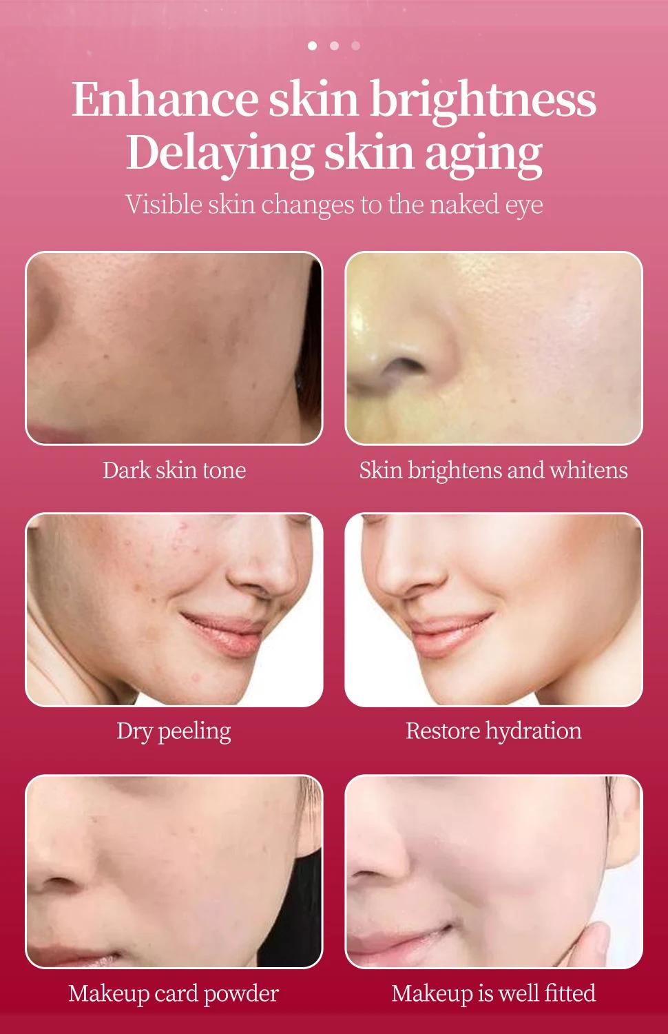 Ampoule de soin pour le visage, Essence PDRN, saumon, oxygène, tige cellulaire, blanchissant, Anti-â