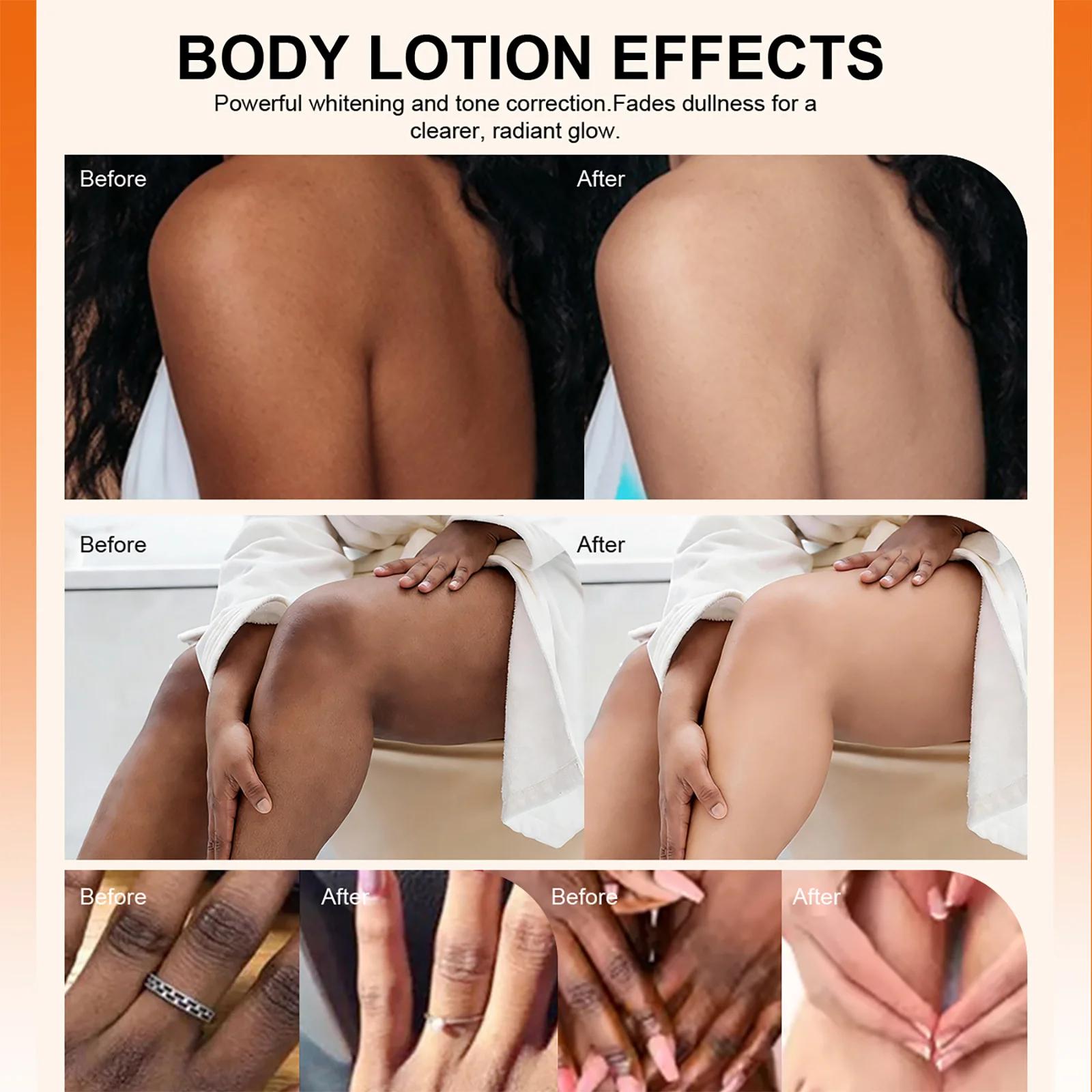 LKIAE Lotion Corporelle Éclaircissante à l'Arbutine et à la Papaye, Crème Hydratante, Améliore les P