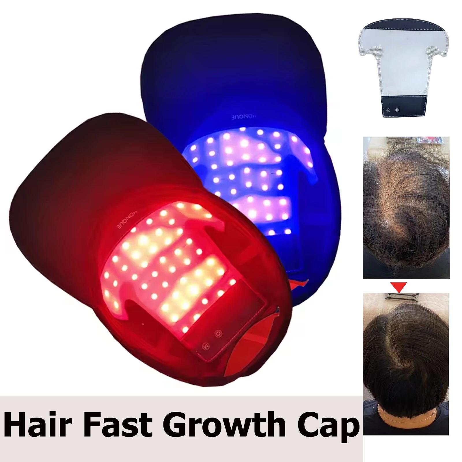 Bonnet de thérapie à la lumière rouge LED, casque de croissance des cheveux, chapeau laser à Diode, 