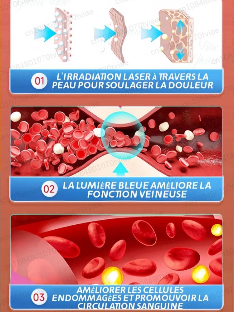 Promouvoir la circulation sanguine dans les varices
