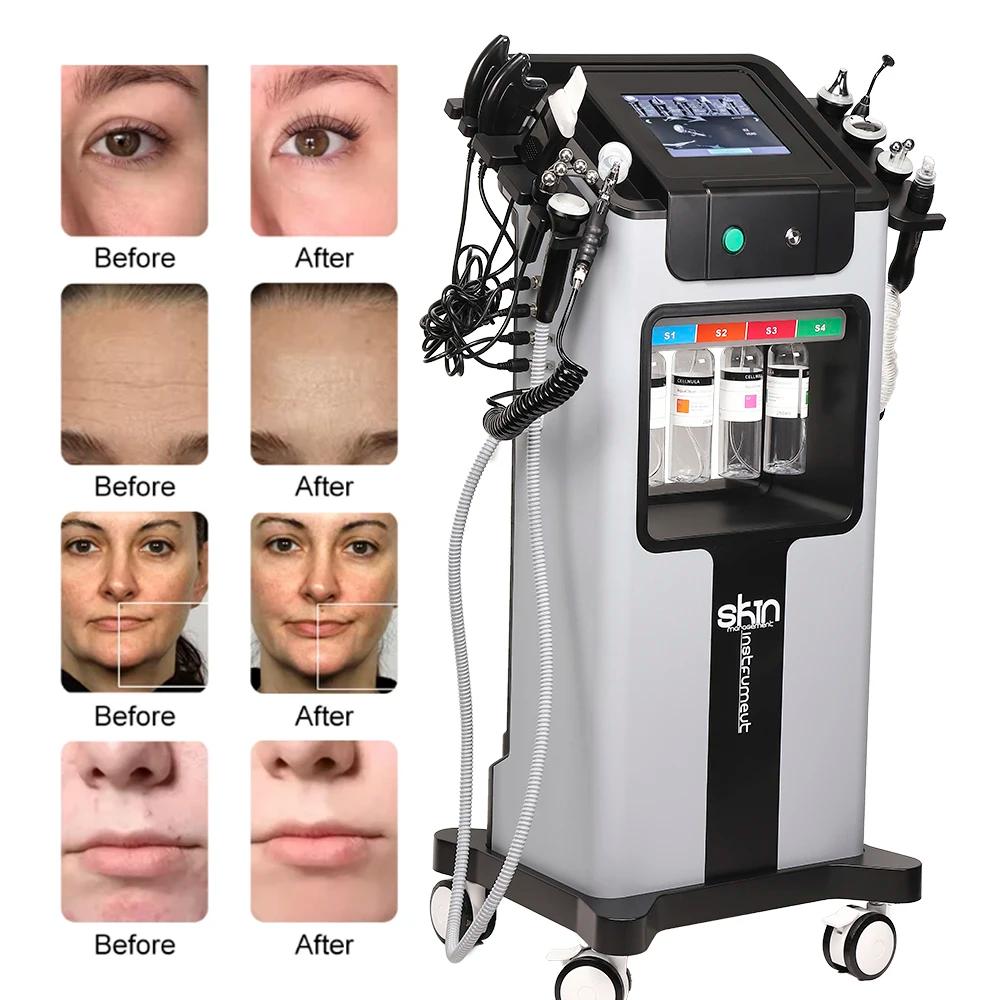 Missheart 10 en 1 eau oxygène Hydro Machine nettoyage en profondeur exfoliant gestion de la peau rég