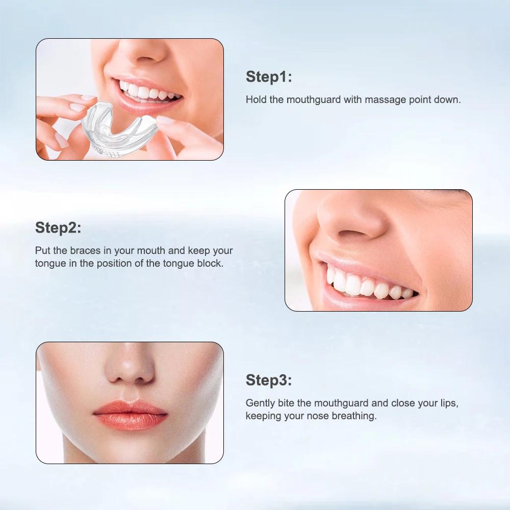 Appareil dentaire, accolades orthodontiques, entraîneur de dents, entraîneur d'alignement, embout po