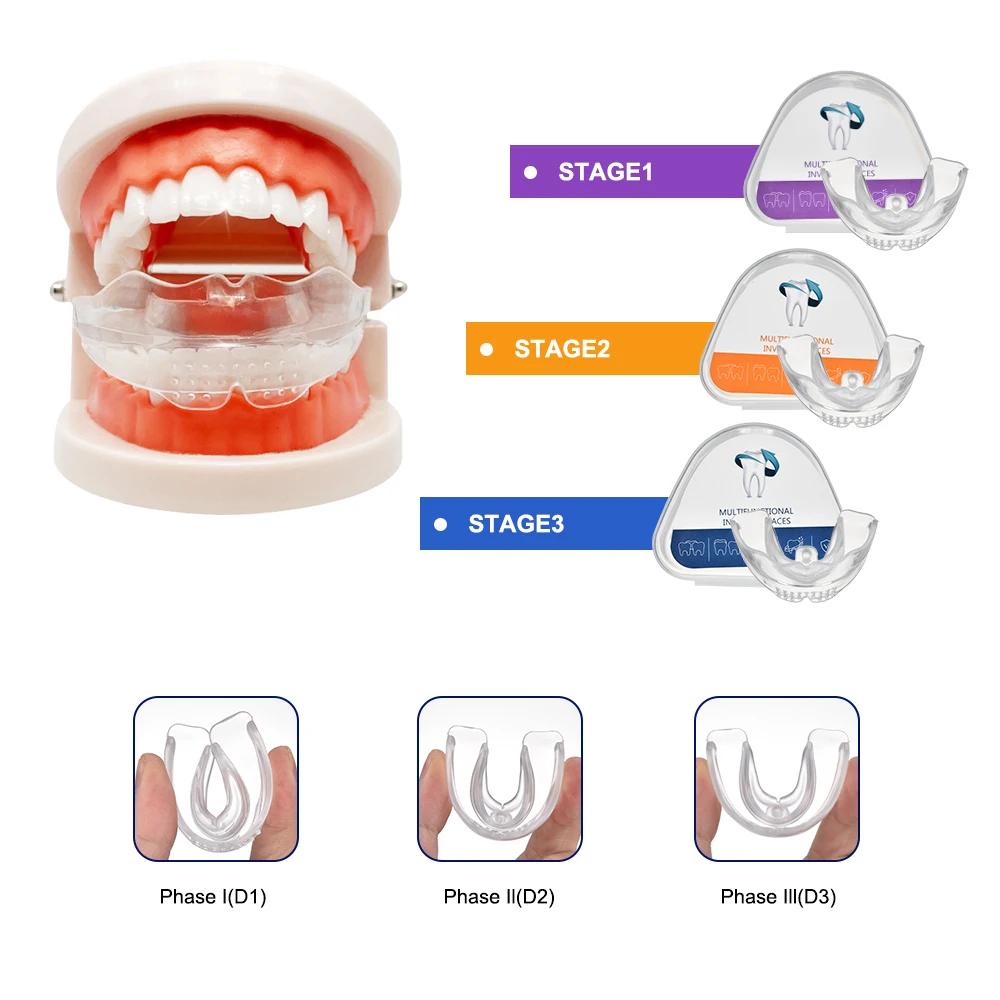 Appareil dentaire, accolades orthodontiques, entraîneur de dents, entraîneur d'alignement, embout po