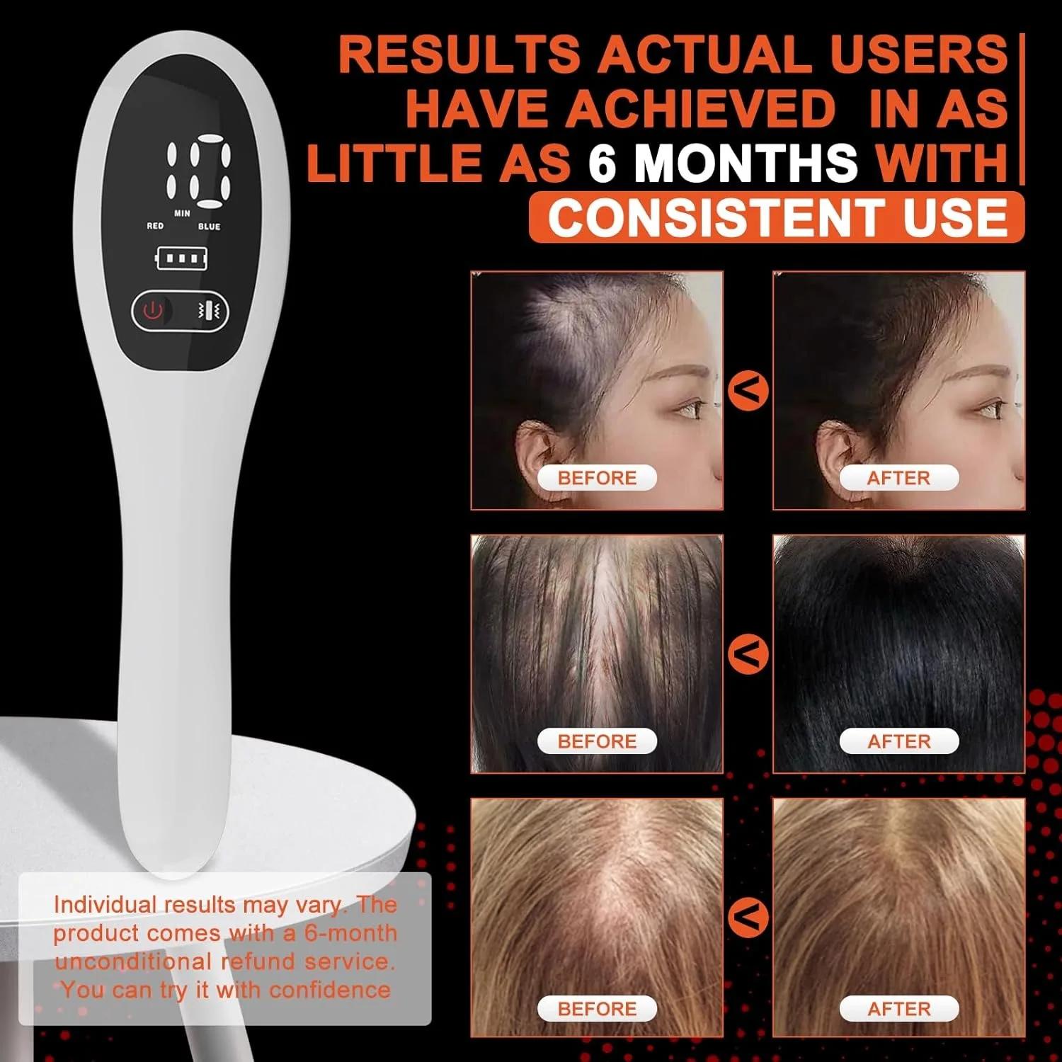 Peigne Laser Électrique pour la Croissance des Cheveux, Thérapie Anti-Perte de Cheveux, Infrarouge 6