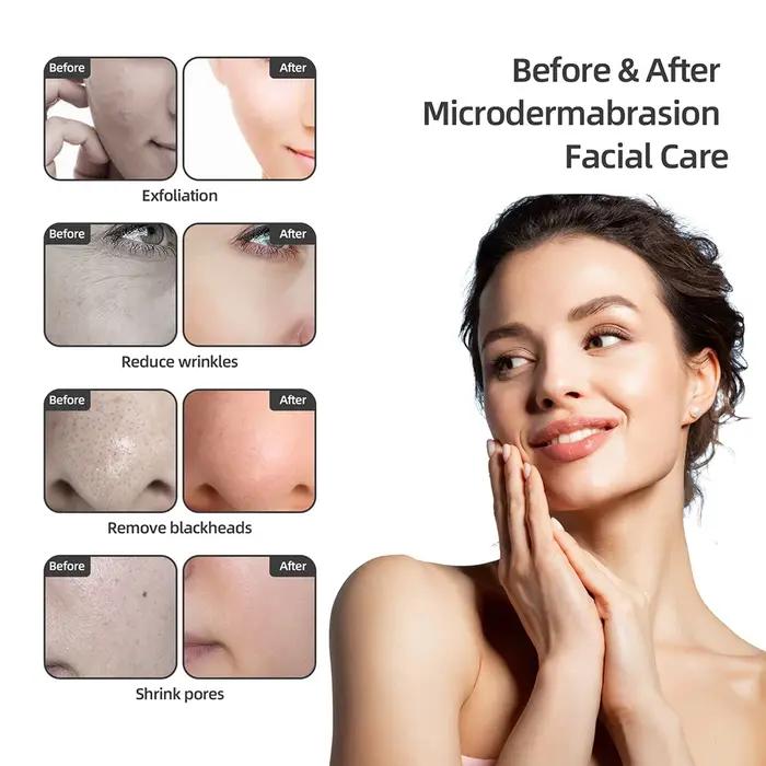 Machine professionnelle de microdermabrasion au diamant, pulvérisation d'eau, exfoliation du visage,